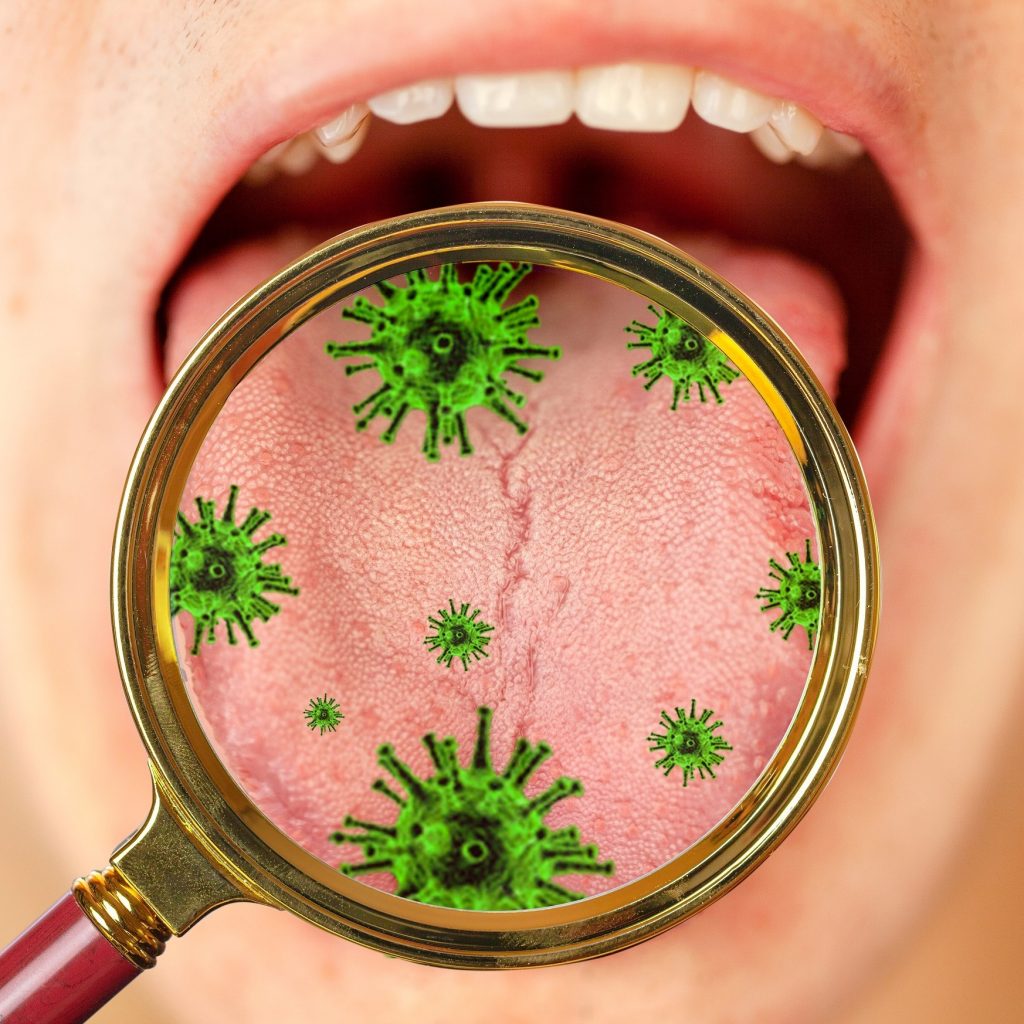 Δείξε μου το χρώμα της γλώσσας σου να σου πω από τι πάσχεις