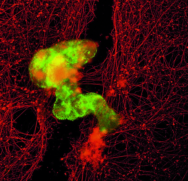 Τα πρώτα «ζωντανά» ανθρώπινα ρομπότ