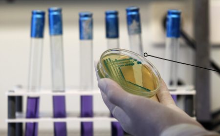 Ε.coli: Εντοπίστηκε νέο άκρως μολυσματικό και «υπερανθεκτικό» στέλεχος