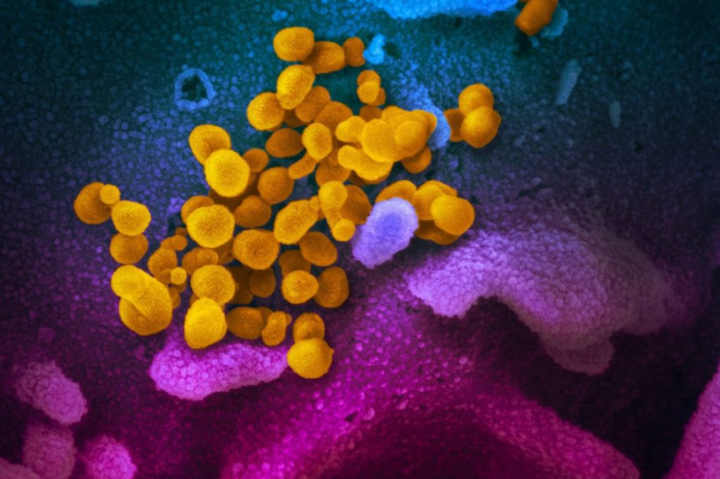 Έρπητας Ζωστήρας: Ποια τα συμπτώματα και πώς αντιμετωπίζεται