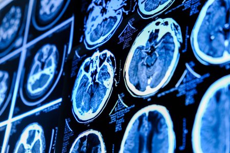 Ποιος είναι ο νέος μηχανισμός επικοινωνίας που ανακαλύφθηκε στον εγκέφαλο;