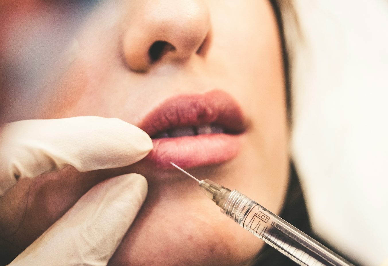 Αισθητικές επεμβάσεις ρεκόρ στην Ελλάδα – Το Botox, οι άνδρες και η πρωτιά στους νέους