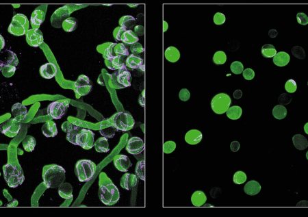 Μαύρος μύκητας: Τι είναι και πώς μεταδίδεται η φονική λοίμωξη – Η μελέτη με ελληνική «υπογραφή»
