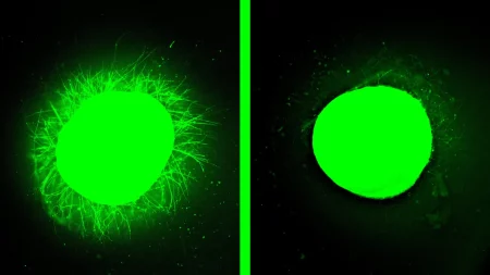 «Θεραπεία που χορεύει» αποκατέστησε τραυματισμό σε νωτιαίο μυελό εργαστηρίου