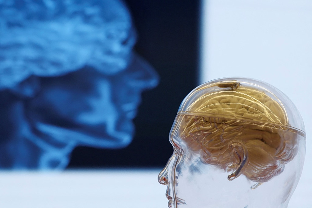 Τι είναι το ανεύρυσμα εγκεφάλου και ποια τα επικίνδυνα συμπτώματα